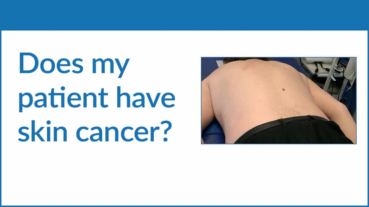 Skin Cancer Diagnosis (CME) Skin Cancer Diagnosis (CME)