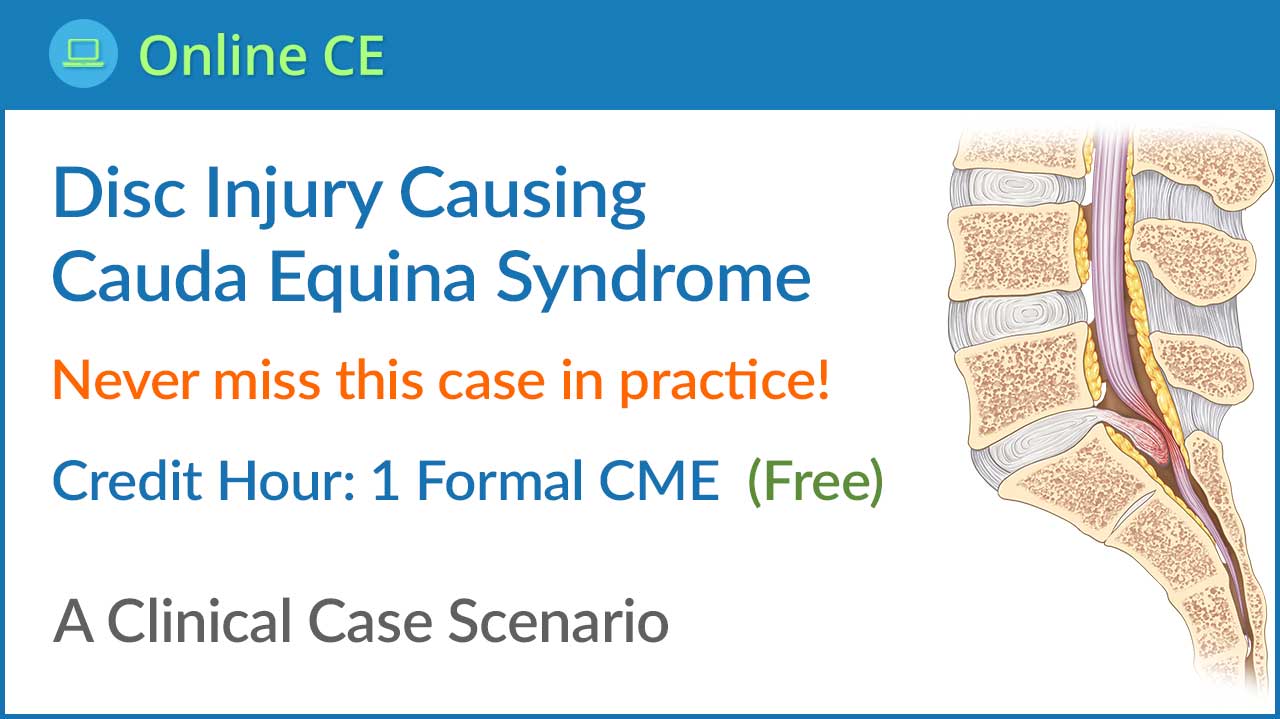 Disc Injury Causing Cauda Equina Syndrome Disc Injury Causing Cauda Equina Syndrome